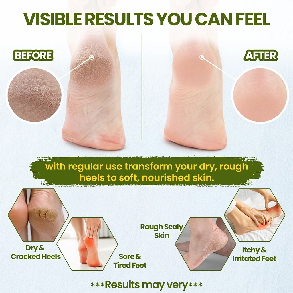 Before and after comparison of foot care product on feet with text highlighting visible results.